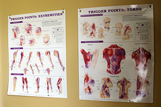 Trigger Point Therapy